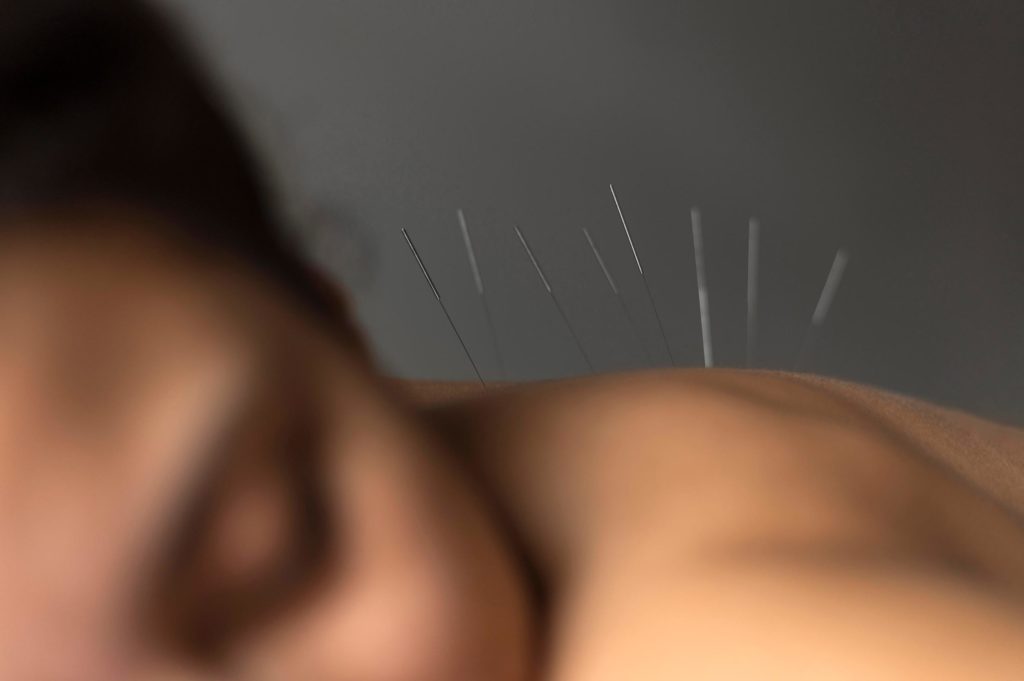femme couchée La Médecine Traditionnelle Chinoise (MTC) méthode thérapeutique chinoise thérapie chinoise geneve